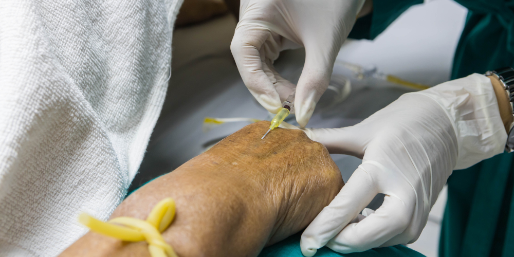 UVA Preventing HACS Transformation